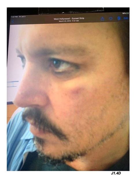 Johnny Depps Scratched And Bruised Face After Being Slapped By Amber Heard Mirror Online
