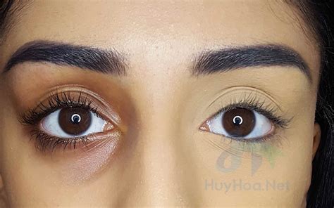 Best For Under Eye Circles Beauty And Health