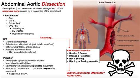 Abdominal Aortic Aneurysm Aaa Presentation Risk Factors And Signs Symptoms Youtube