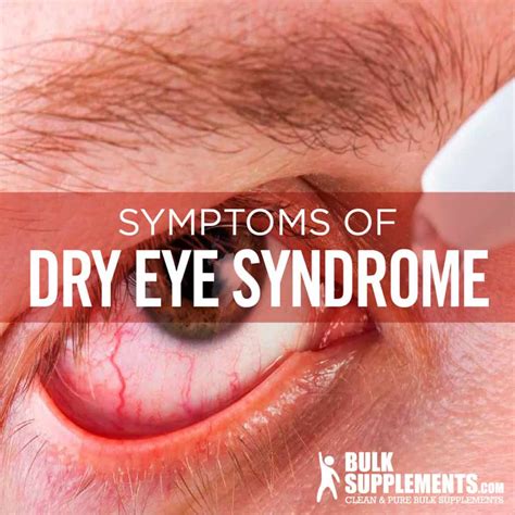 Dry Eye Syndrome Symptoms Causes And Treatment