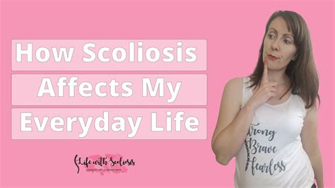 How Scoliosis Affects My Everyday Life Life With Scoliosis Blog Youtube