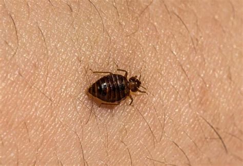 Dust Mite Bites Vs Bed Bug Bites Whats The Difference Pestopped