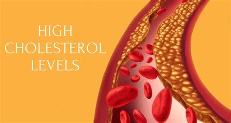 experts warn of silent epidemic of high cholesterol in the uk general news nsane forums