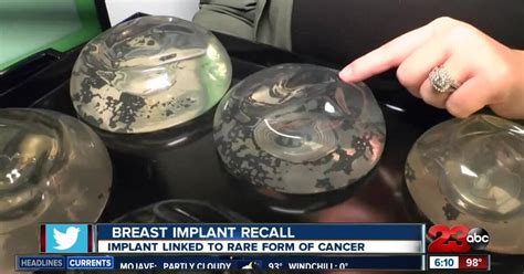 Breast Implant Recall Linked To Rare Form Of Cancer