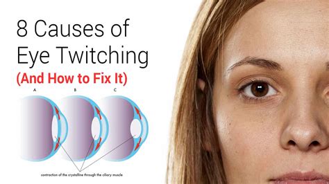 8 Causes Of Eye Twitching And How To Fix It 5 Minute Read