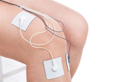 Electrical Stimulation For Stroke Patients How It Works Stroke Rehab