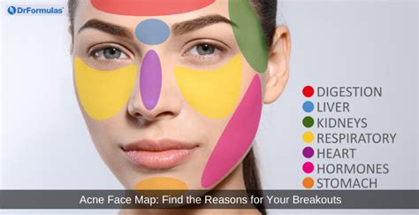Acne Face Map The Reasons For Your Breakouts Drformulas