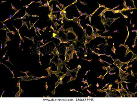 Real Fluorescence Microscopic View Human Skin Stock Photo 1366688945