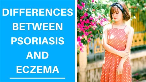 Differences Between Psoriasis Vs Eczema Youtube