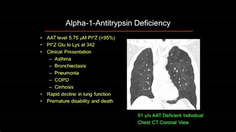 Onset of lung problems is typically between 20 and 50 years old. Alpha-1 Antitrypsin Deficiency 101: Lung - YouTube