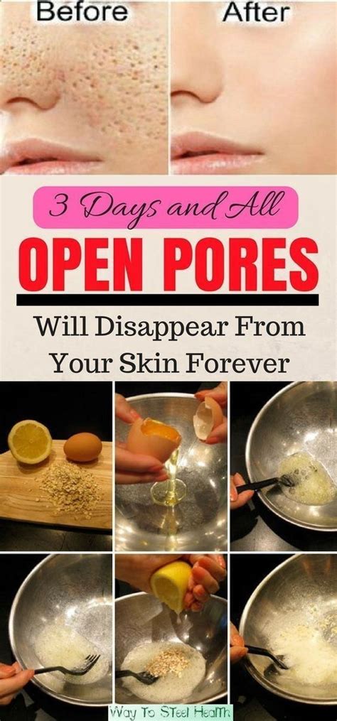 3 days and all open pores will disappear from your skin forever with images skin care