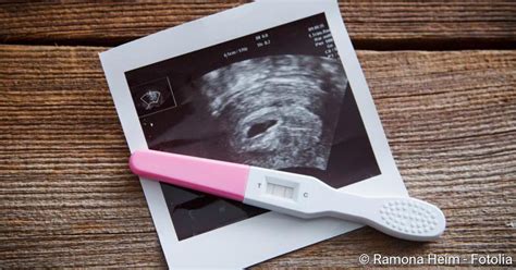 Schwangerschaftstest Ab Wann Er Aussagekräftig Ist Netdoktorde