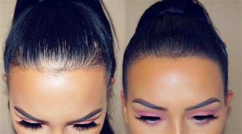 Hair loss around the hairline can be a discouraging issue to deal with. How to Cover Receding Hairline with Makeup - 365 gorgeous