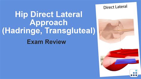 Hip Direct Lateral Approach Hadringe Or Transgluteal Exam Review