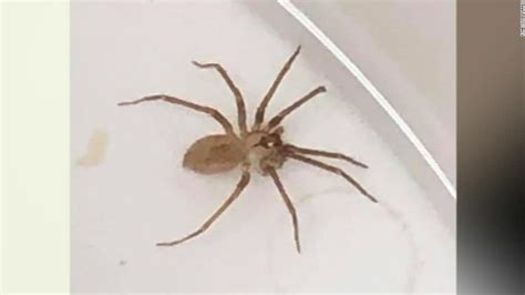 Doctors Pull Brown Recluse Spider From A Womans Ear Cnn Video