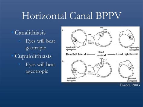 40 Best Health Bppv Images On Pinterest Physical Therapy Vertigo