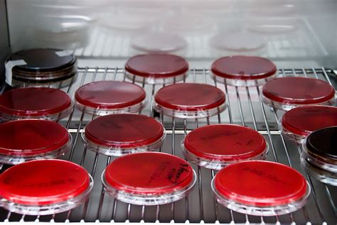 Blood Agar Culture Plates In Incubator Bild Kaufen 12042165 Science