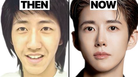 Korean Actors Who Ruined Their Face With Too Much Plastic Surgery
