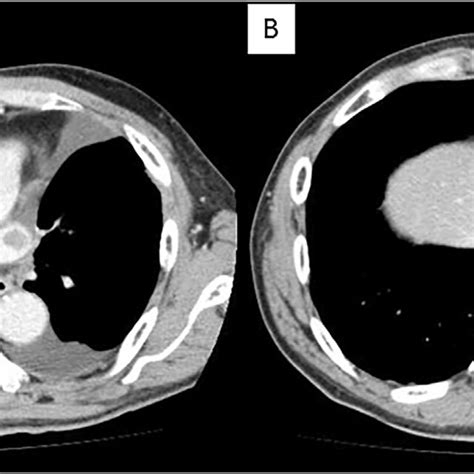 Three Dimensional Contrast Enhanced Computed Tomography Image Of The