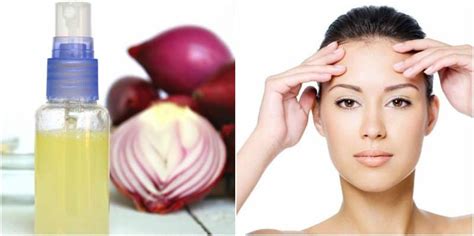 Maybe you would like to learn more about one of these? Stop Receding Hairline With These 8 Home Remedies