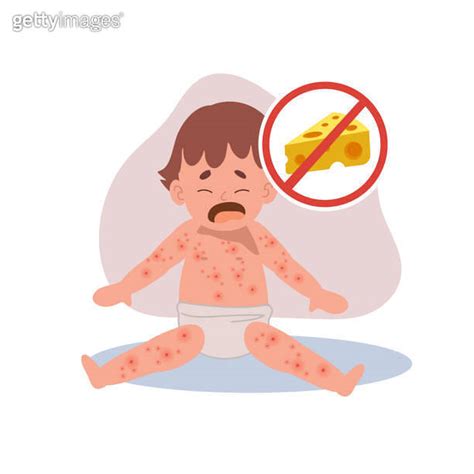 Allergic Reactions In Infants Baby With Skin Rash Baby Food Allergy