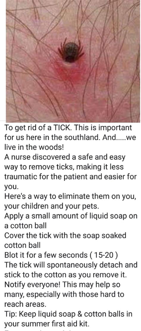 Pin By Janie Hardy Grissom On Health Healthbeauty Tips Tick Removal