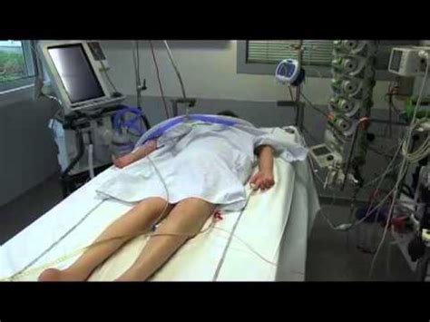 Prone Position Ventilation