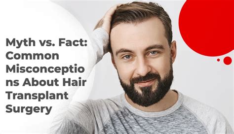Myth Vs Fact Common Misconceptions About Hair Transplant Surgery