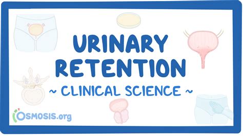 Urinary Retention Clinical Sciences Osmosis Video Library