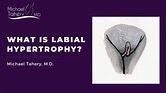 What is Labial Hypertrophy? - YouTube