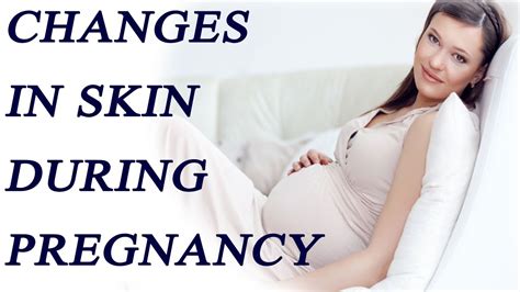 Skin Changes During Pregnancy All You Need To Know Boldsky Youtube