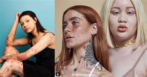 Una Empresa Dedicada A La Moda Lanzó Campaña Para Resaltar La Belleza En Mujeres Muy Diferentes