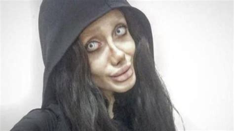 Woman Allegedly Gets 50 Surgeries To Look Like Angelina Jolie Sports