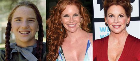 Melissa Gilbert Plastic Surgery Before And After Pictures 2021
