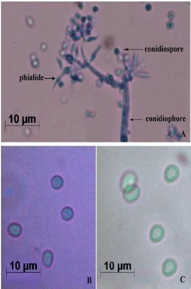 A single, slender, tubular conidiophore. Morphological characterization of T. viride . (A) Mycelia ...