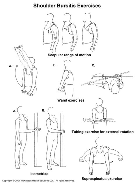 · shoulder impingement exercises to avoid when recovering from shoulder impingement, you should steer clear of any. Sports Medicine Advisor 2003.1: Shoulder Bursitis ...