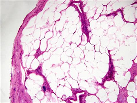 Adipose Tissue Histology Adipose Tissue Histology Slide
