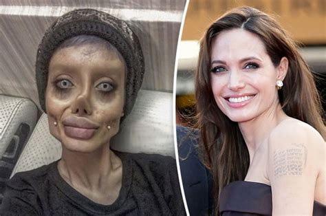 Teenager Has EXTREME Plastic Surgery To Look Like Angelina Jolie