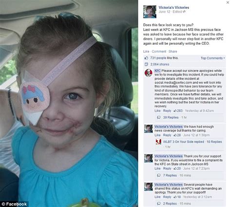 Victoria Wilcher Girl In Kfc Hoax Gets New Eye After Fast Food