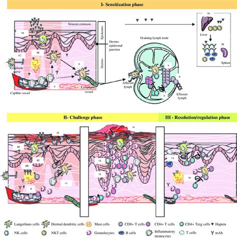 Schematic Representation Of The Pathophysiology Of Allergic Contact