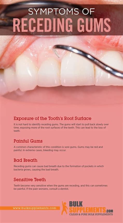 Receding Gums Symptoms Causes And Treatment By James Denlinger