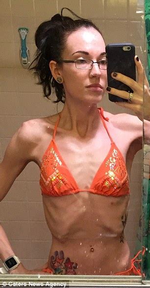 Anorexic Gym Addict Whose Weight Fell To St Finally Hit A Healthy
