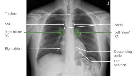 Pulmonary Radiology Concise Medical Knowledge