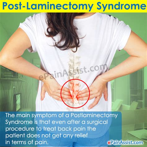 Post Laminectomy Syndrome Icd 10 Asking List