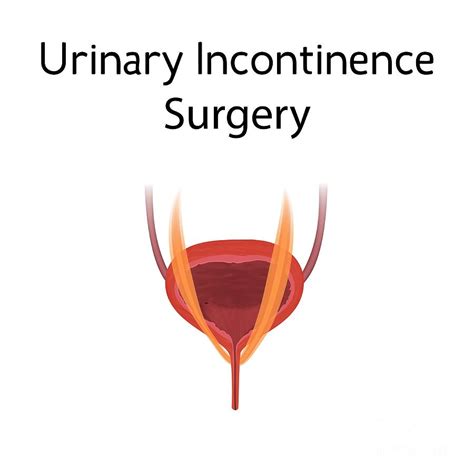Urinary Incontinence Surgery Photograph By Veronika Zakharovascience