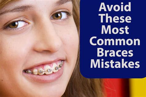 How To Tell If You Need Braces Again Reverasite