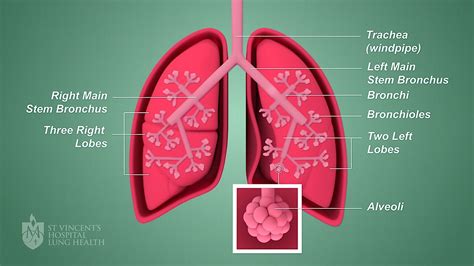 Your Lungs St Vincents Lung Health