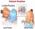 Lumbar Puncture Procedure - Position & Lumbar Puncture Side Effects