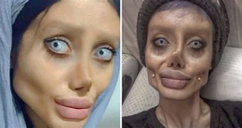 Girl Who Underwent Surgery To Look Like Angelina Jolie Was All Just Genius Photo Editing That