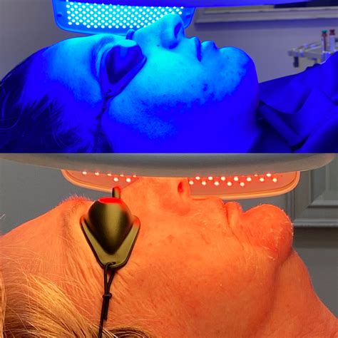 Led Therapy Laser Perfect